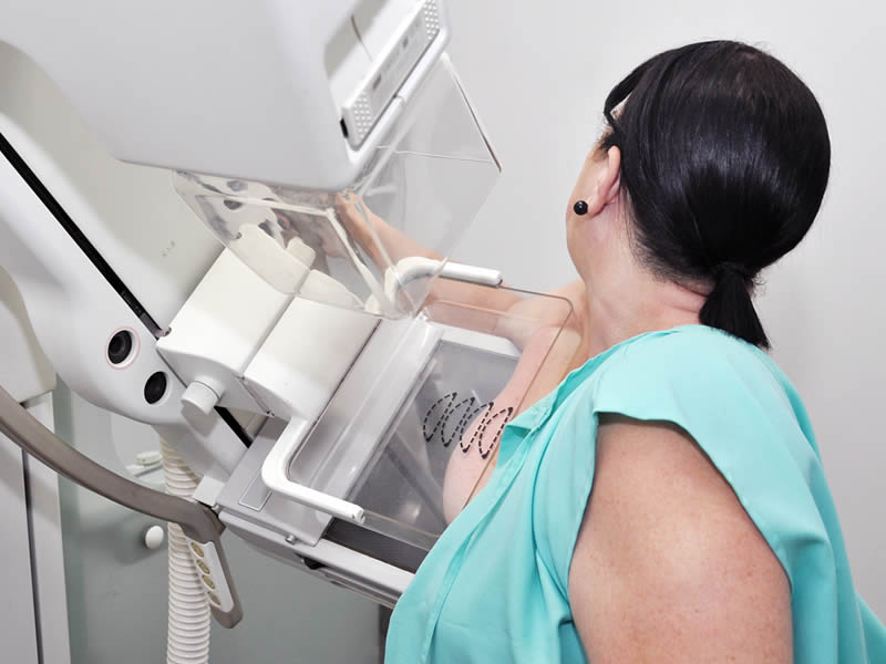 Sesab oferta dez mil mamografias com horário marcado para evitar aglomeração
