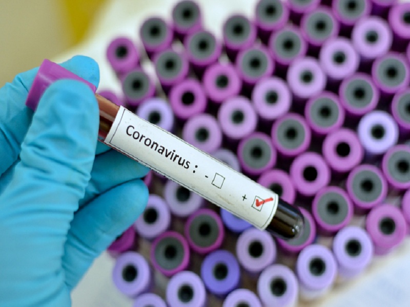 Alerta: 64 casos confirmados de coronavírus (covid-19) no Subúrbio