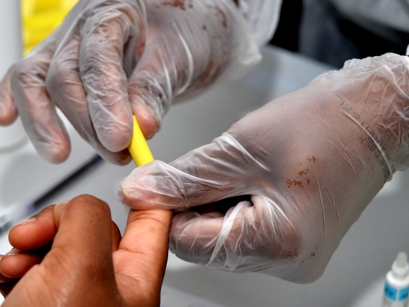 Julho Amarelo: Saúde promove ações de diagnóstico e tratamento às hepatites virais